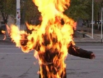 Siqaret çəkmək istəyən gənc özünü yandırdı