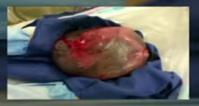 Qadın yumurta dünyaya gətirdi, içindən uşaq çıxdı -