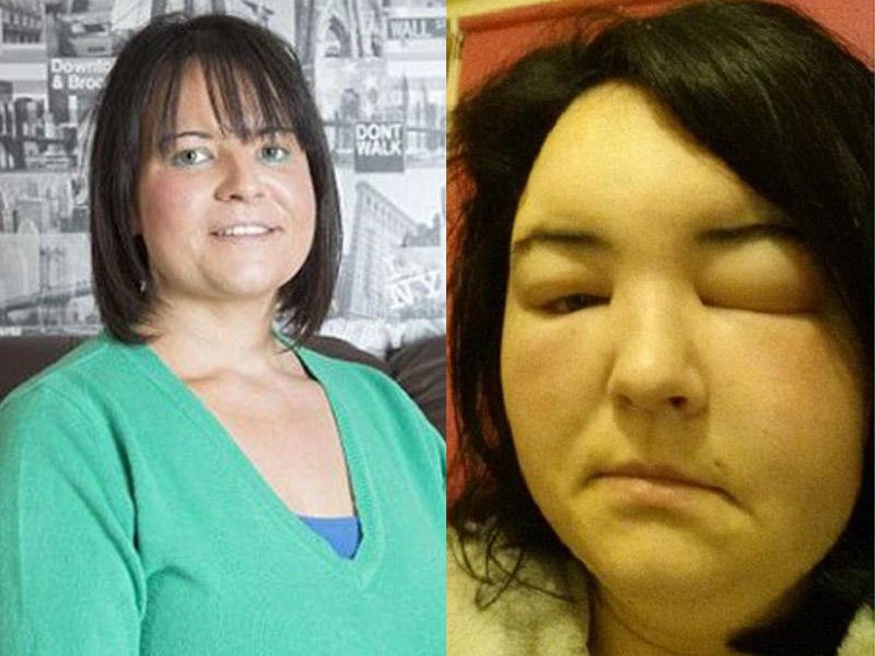 Saç boyası qadını xəstəxanalıq etdi