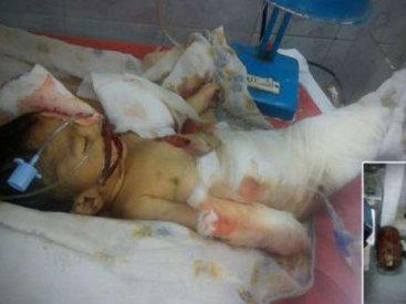 Siçanlar 10 günlük körpəni öldürdülər