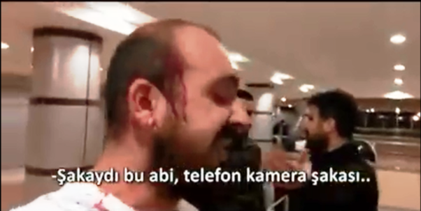 Kamera zarafatı etdi, başını yardılar