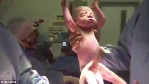 Ananın doğum anı ANBAAN KAMERADA