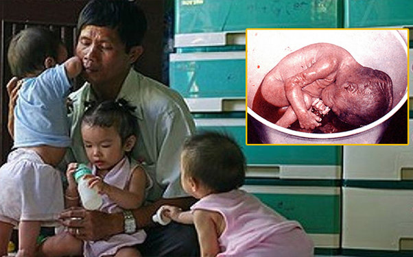 O, abort edilmiş uşaqların cəsədlərini klinikadan alır və...