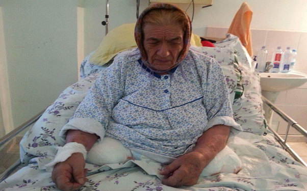 Xəstənin sağlam ayağını kəsən həkim və klinikanın direktoru işdən azad olundu