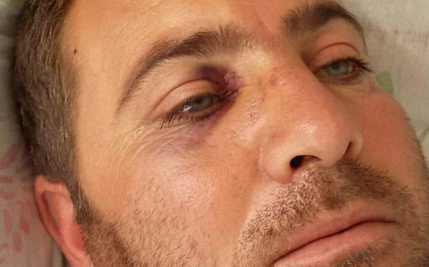 Tərtərdə köçkün ailələri arasında əlbəyaxa: