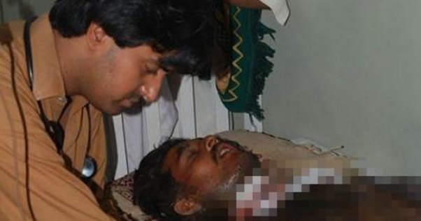 Evli qadın sevgilisini turşu ilə yandırdı