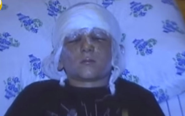 Tərtərdə hərbi sursat partladı, 8 yaşlı uşaq yaralandı