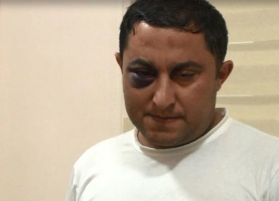 “Kor Elçin” ləqəbli narkobaron tutuldu