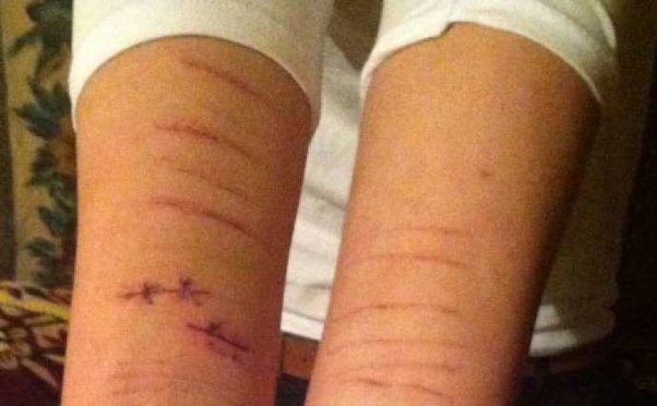 Bakıda polis idarəsində saxlanılan şəxs özünü doğrayıb