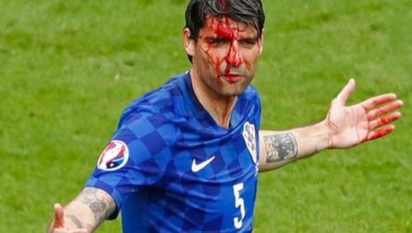 Xorvat futbolçu qan içində