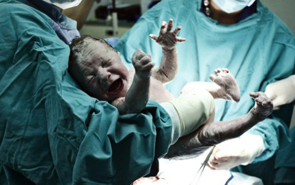 Bakıda məşhur klinikada həkim doğuş zamanı qaçıb?