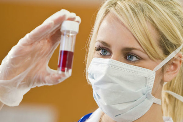 Ailə qurmaq istəyən 85 nəfərdə “SPİD” aşkarlandı