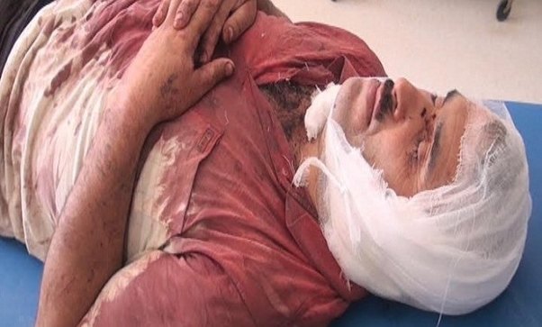 Lerik sakininin qulağını kəsən 2 nəfər saxlanılıb