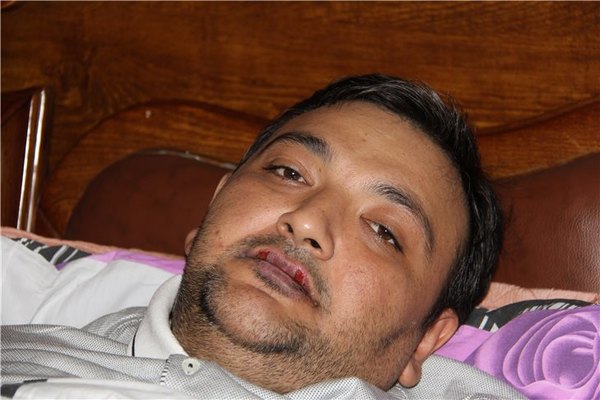 “Bilirəm, Prezident mənə kömək edəcək”