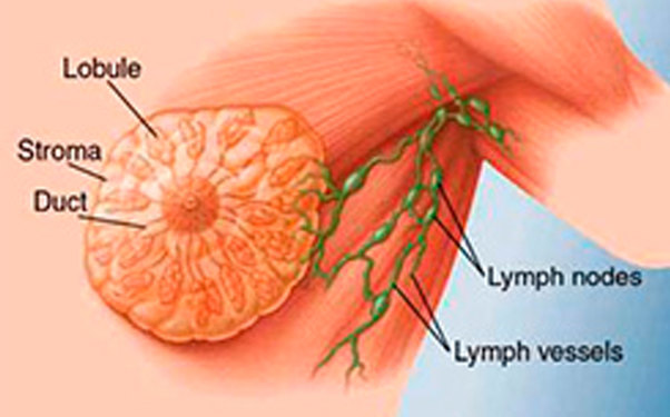 Alimlər döş xərçənginin yaranma səbəbini tapıblar