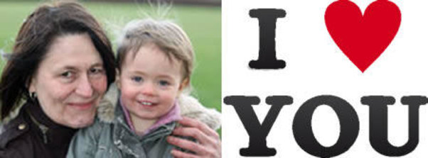 Xəstəliyi ilə dünyanı təəccübləndirən qadın