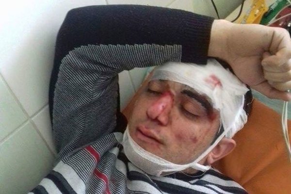 Lvovda ermənilərin yaraladığı azərbaycanlıların kimliyi məlum oldu