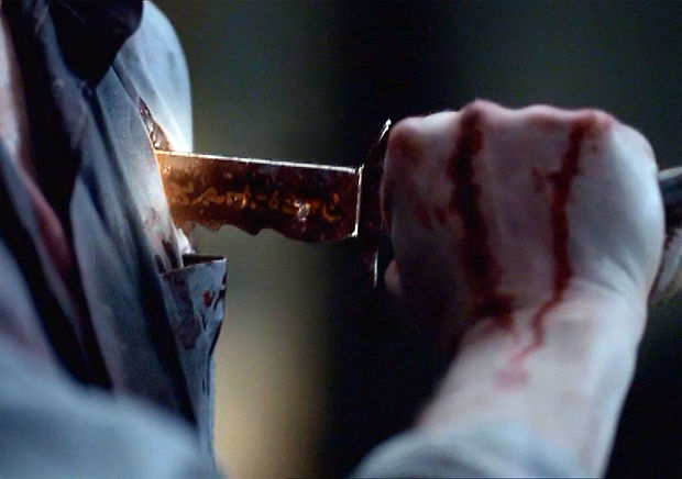 Yardımlıda 12 yaşlı uşaq özünü bıçaqlayıb