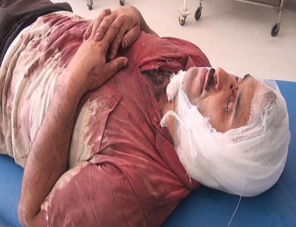 Ağdaşda 45 yaşlı kişinin qulağını kəsdilər – FOTO