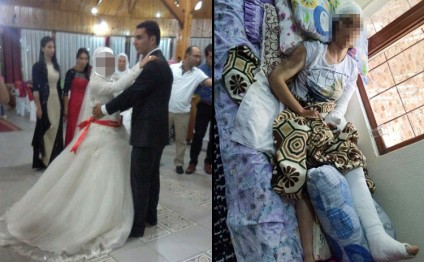 ŞOK! Təzə gəlinin dişlərini sındırıb ağzına ilan soxdular