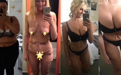 İnanılmaz dəyişim: bu qızın bədəni görənləri heyrətə gətirir - FOTOLAR