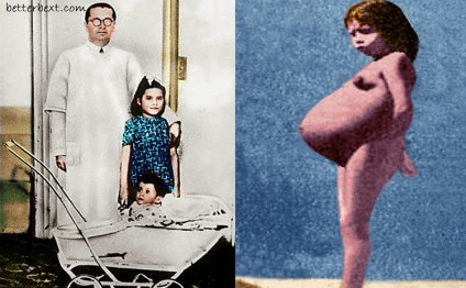 ŞOK: 5 yaşında hamilə qaldı və doğdu - FOTOLAR