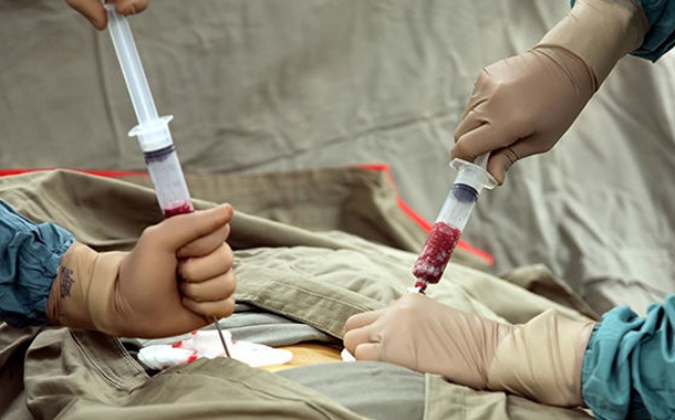 Azərbaycanda 24 nəfərə sümük iliyi köçürülüb