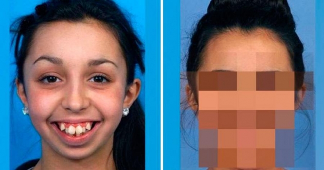 Özünü eybəcər sayan qız o qədər dəyişdi ki... FOTOLAR