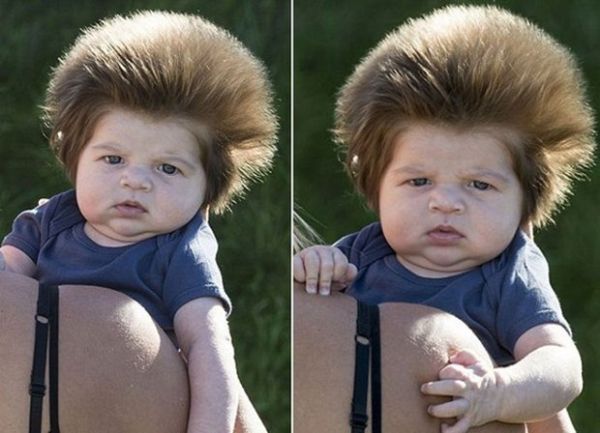 Bütün dünya bu körpədən danışır - 2 aylıq olsa da... - FOTOLAR