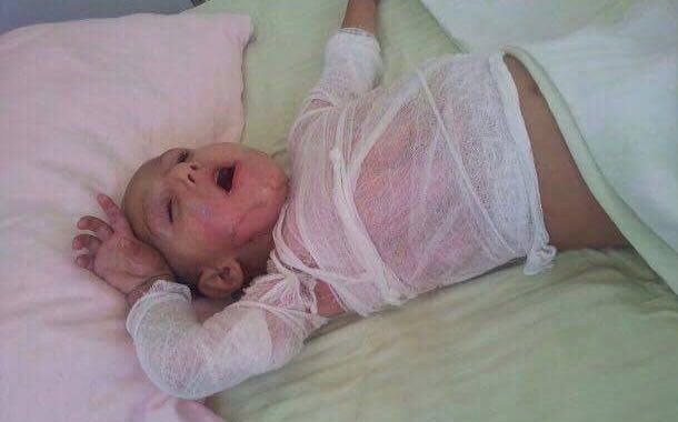 SƏHİYYƏDƏ BİABIRÇILIQ: Uşağı yanan ana fəryad edir — 5 saylı xəstəxanada RƏZALƏT