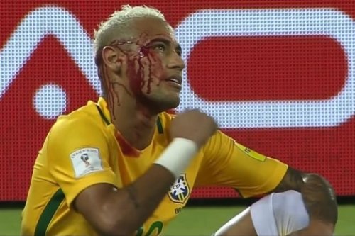 300-cü qolunu vuran Neymar qana bulandı - VİDEO