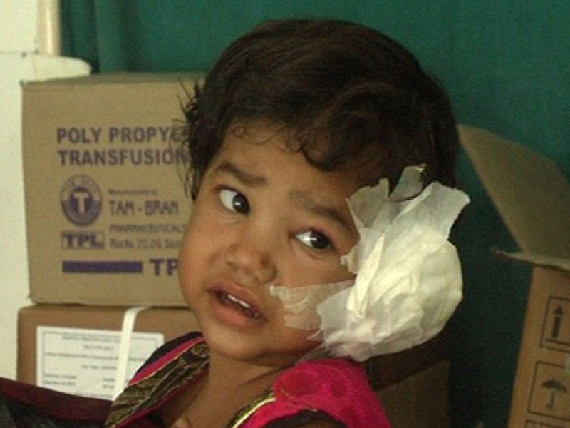 Körpənin qulağından çıxanlar həkimləri ŞOK ETDİ - FOTO