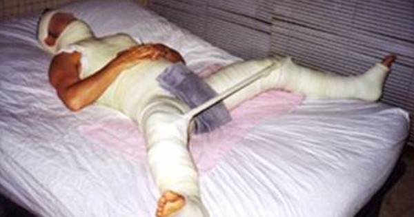 İntim münasibət zamanı cinsiyyət orqanı kökündən qırıldı