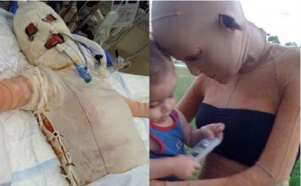 Gözəlliyinə görə üstünə spirt töküb yandırdılar - FOTOLAR