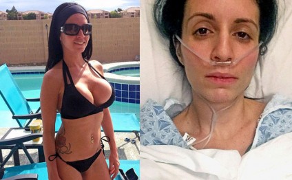 Sinəsinin cazibədar olmasını istəyən qadının 