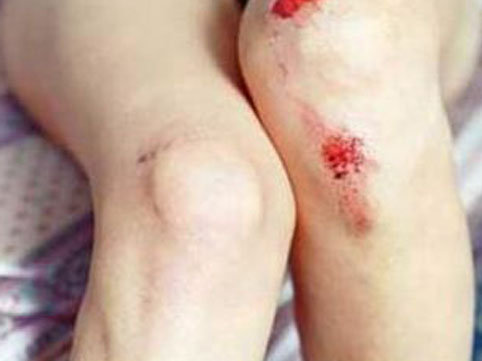 DƏHŞƏT: İki dost qızı belə zorladı, sonra da bişirib yedi - FOTOLAR