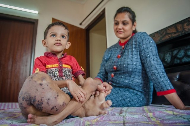 3 yaşlı körpəni görənlər şokda - FOTOLAR