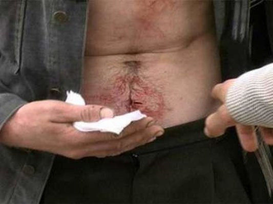 Sevgilisinin qapısını döyən qonşunu deşik-deşik etdi - TƏFƏRRÜAT