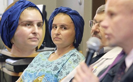 Qadının üzünü dəyişdilər - UNİKAL ƏMƏLİYYAT - FOTOLAR