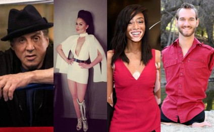 Fiziki qüsuru olan 10 məşhur - Fotolar