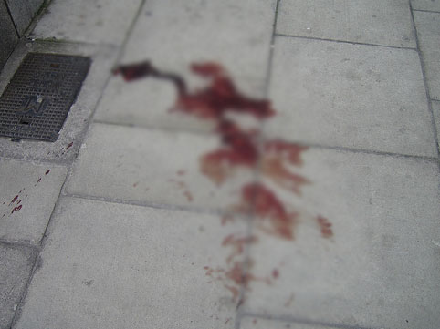 Polis idarəsində özünə amansız işgəncə verdi