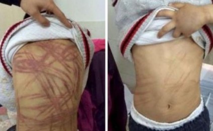 Ögey ana 9 yaşlı uşağa DƏHŞƏTLİ İŞGƏNCƏLƏR verdi - FOTOLAR