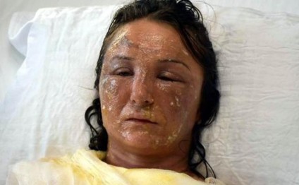 Qayınana gəlinin üzünü yandırdı - Ürəyi zəif olanlar baxmasın! - FOTO+VİDEO