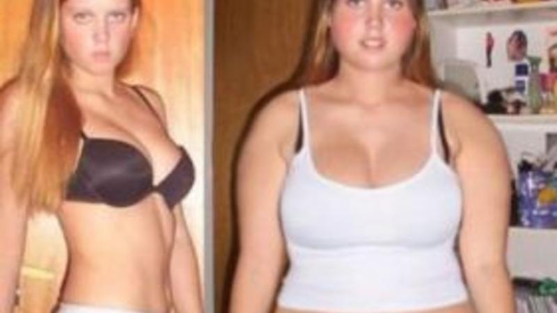 Arıqladıqdan sonra GÖZQAMAŞDIRAN GÖZƏLLƏR - FOTOLAR