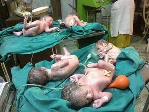 Azərbaycanda şok hadisə- 5 uşaq dünyaya gətirdi