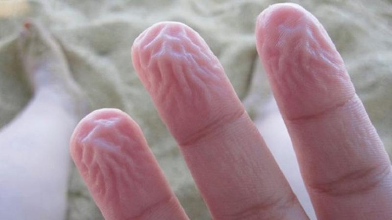 İnsanı qoruyan 9 qəribə hal - FOTOLAR