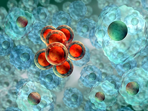 Xərçəngə qarşı mübarizə kökündən səhv gedirmiş