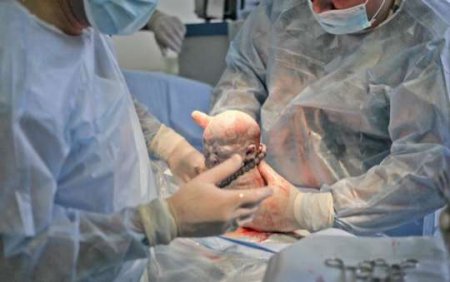 Lənkəranda qorxunc olay - Həkim-qəssabdan ölkəni şoka salan doğuş əməliyyatı...