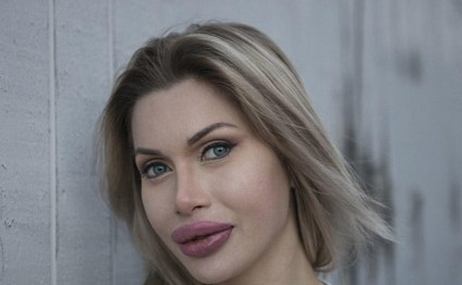 100 dəfə əməliyyat olunmuş qadın: 