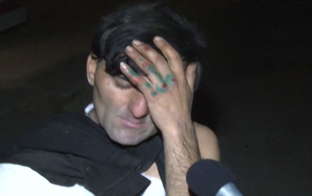 Maştağada “Ceylo”nu maşın vurdu - Foto